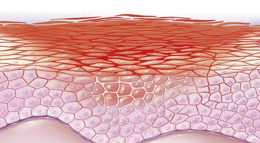 Chronic Inflammation: The Hidden Architect of Systemic Diseases